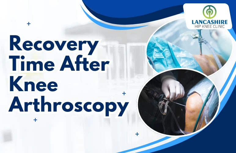 Recovery-Time-After-Knee-Arthroscopy.webp