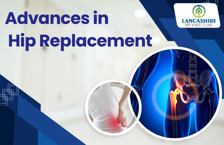 Advances-in-Hip-Replacement.webp