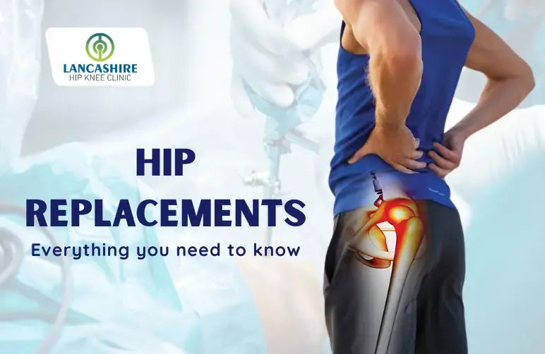 Hip-replacements-Everything-you-need-to-know-1.webp