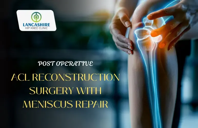 Post-Operative-ACL-Reconstruction-Surgery-with-Meniscus-Repair.webp